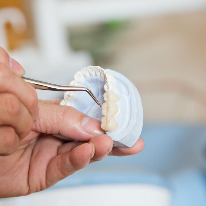 Laboratoire de prothèse dentaire adjointe Le Thor